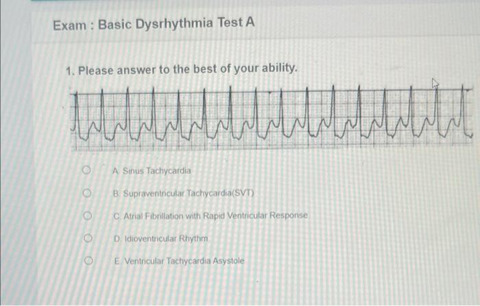 Relias advanced dysrhythmia exam a